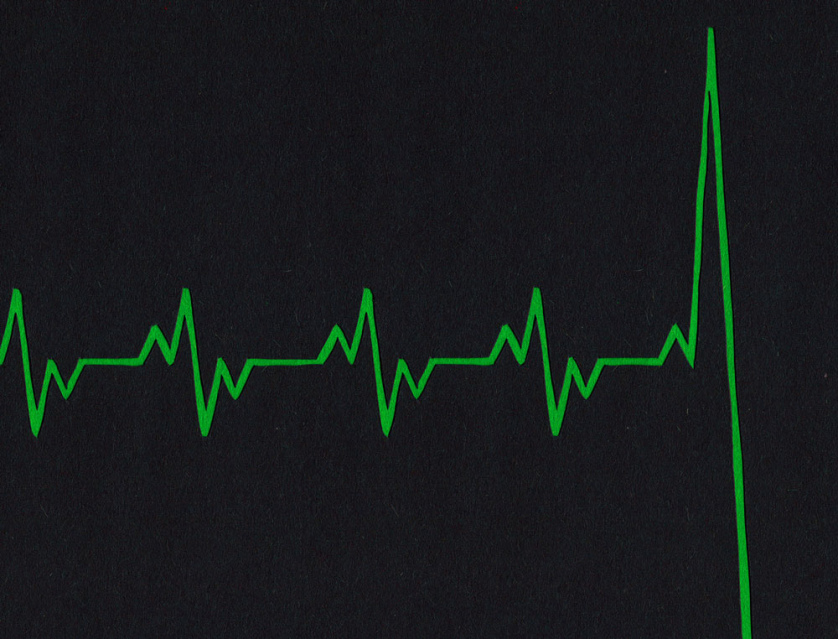 A black and green graphic of a heart rate monitor where the line dives precipitously.