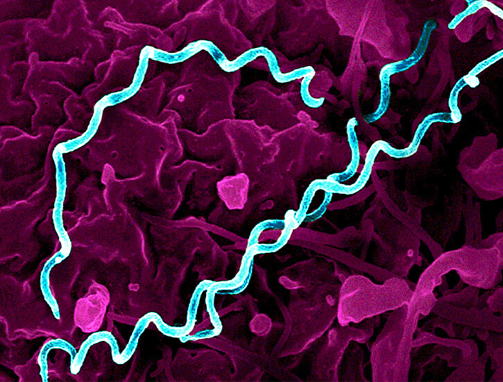 Colorized electron micrograph of Treponema pallidum, the bacteria that cause syphilis.